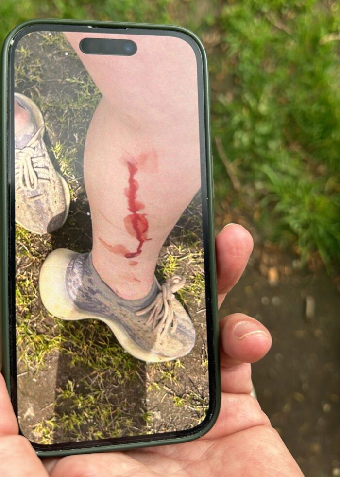 Kinderen beschoten met luchtdrukpistool, één jongen gewond