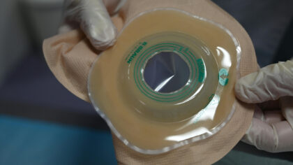 Lotgenotenbijeenkomst voor stomadragers in Helmond