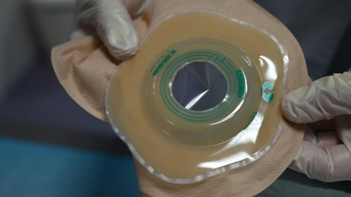 Lotgenotenbijeenkomst voor stomadragers in Helmond